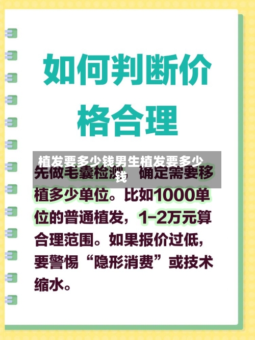 植发要多少钱男生植发要多少钱
