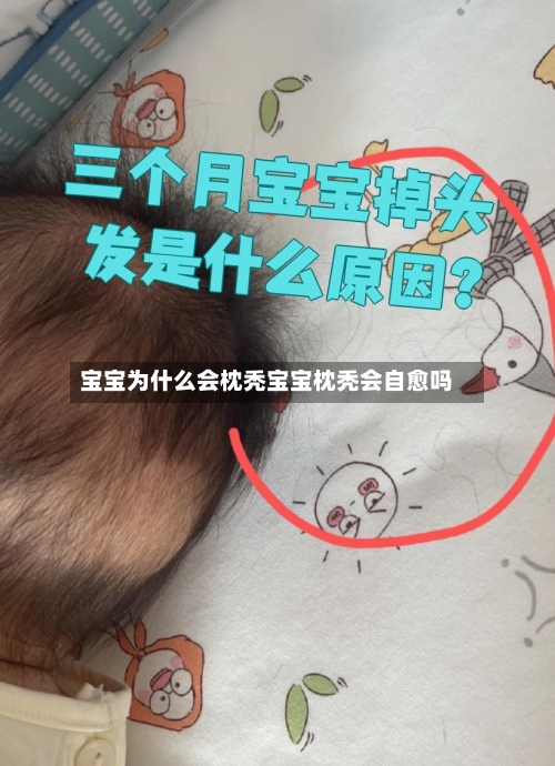 宝宝为什么会枕秃宝宝枕秃会自愈吗