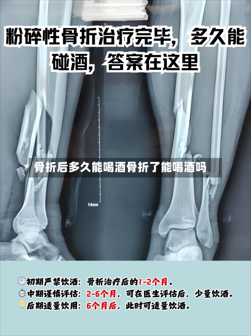 骨折后多久能喝酒骨折了能喝酒吗