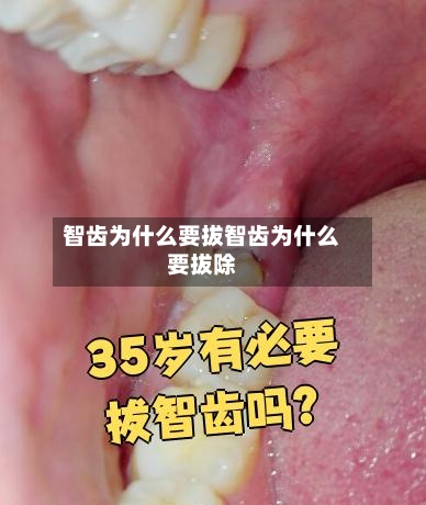 智齿为什么要拔智齿为什么要拔除