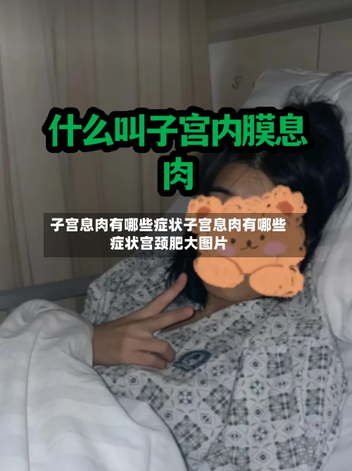子宫息肉有哪些症状子宫息肉有哪些症状宫颈肥大图片