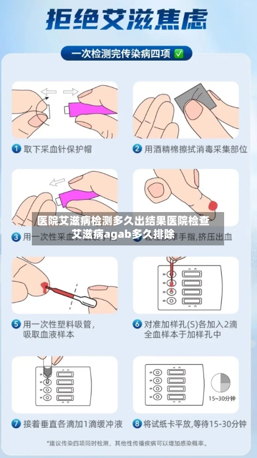 医院艾滋病检测多久出结果医院检查艾滋病agab多久排除