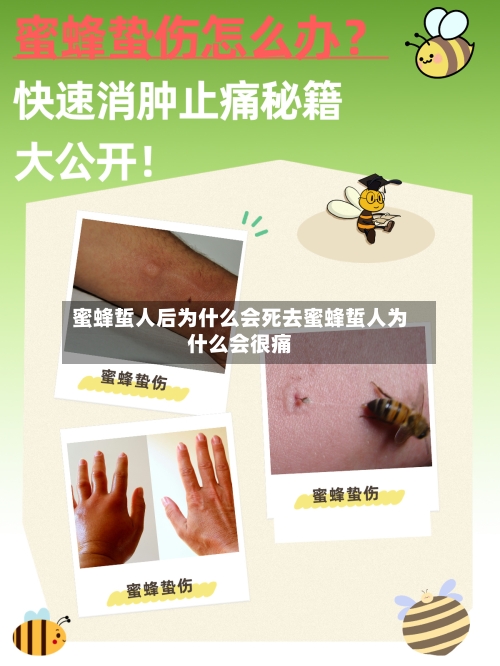 蜜蜂蜇人后为什么会死去蜜蜂蜇人为什么会很痛