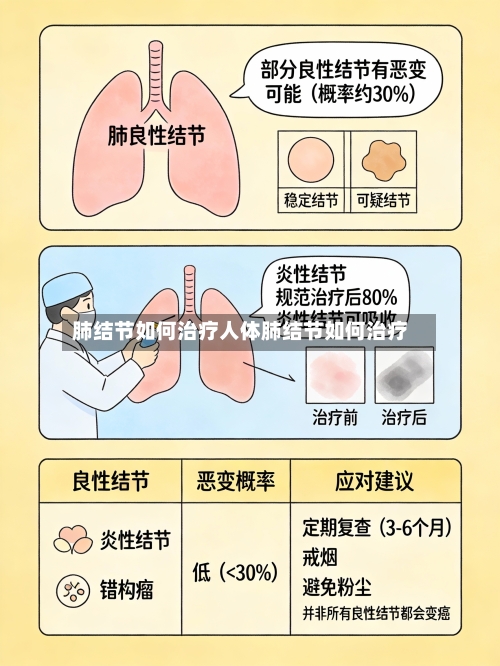 肺结节如何治疗人体肺结节如何治疗
