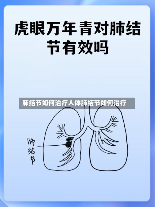 肺结节如何治疗人体肺结节如何治疗