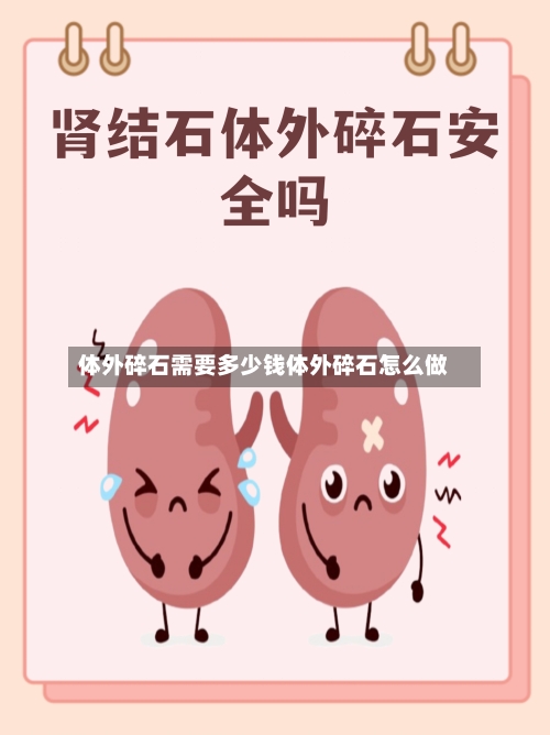 体外碎石需要多少钱体外碎石怎么做