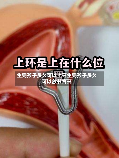 生完孩子多久可以上环生完孩子多久可以放节育环