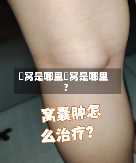 腘窝是哪里腘窝是哪里?